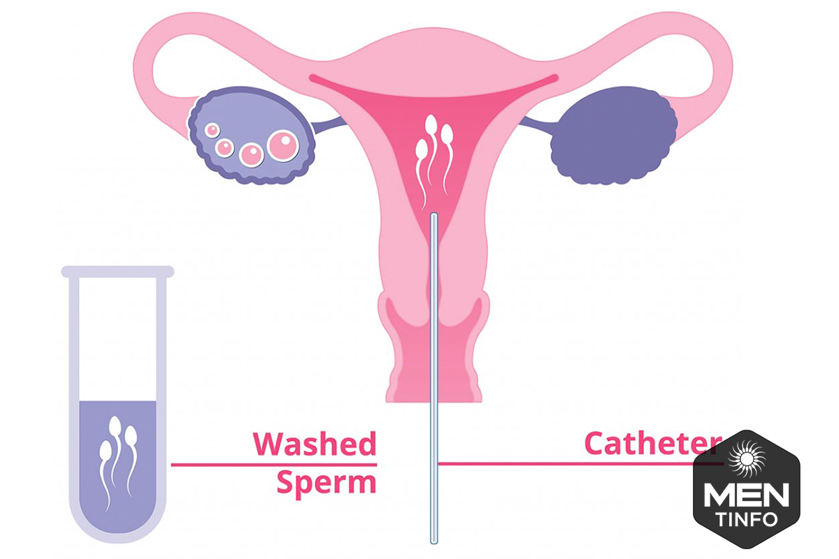 tinh-trung-yeu-va-cach-dieu-tri3