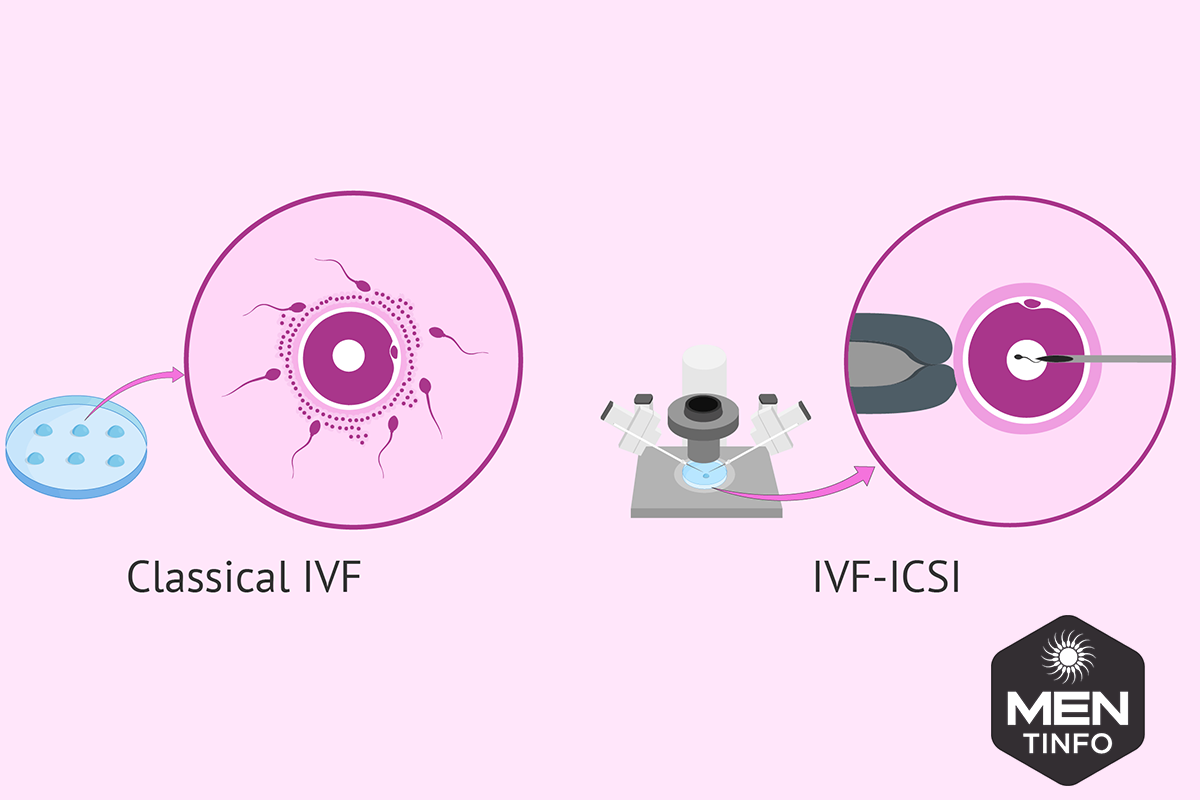 dieu-tri-tinh-trung-yeu3