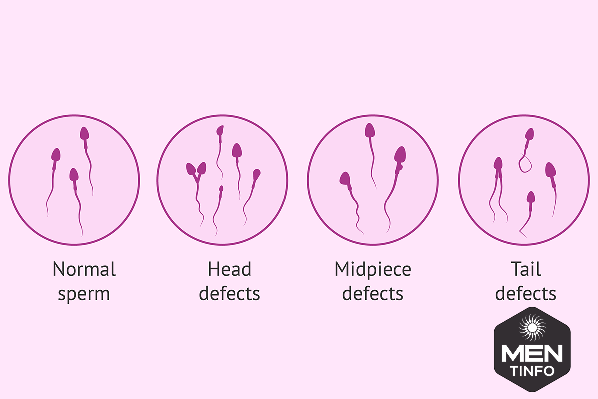 tinh-trung-yeu-co-anh-huong-den-thai-nhi2
