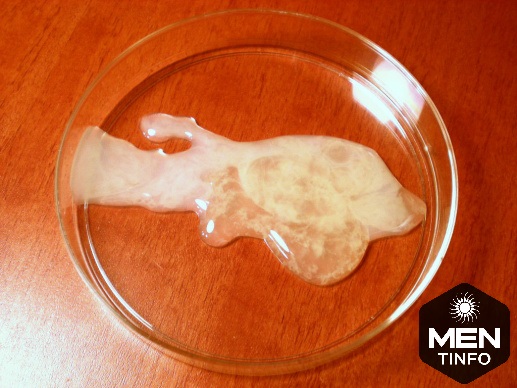 bai-thuoc-dan-gian-chua-tinh-trung yeu