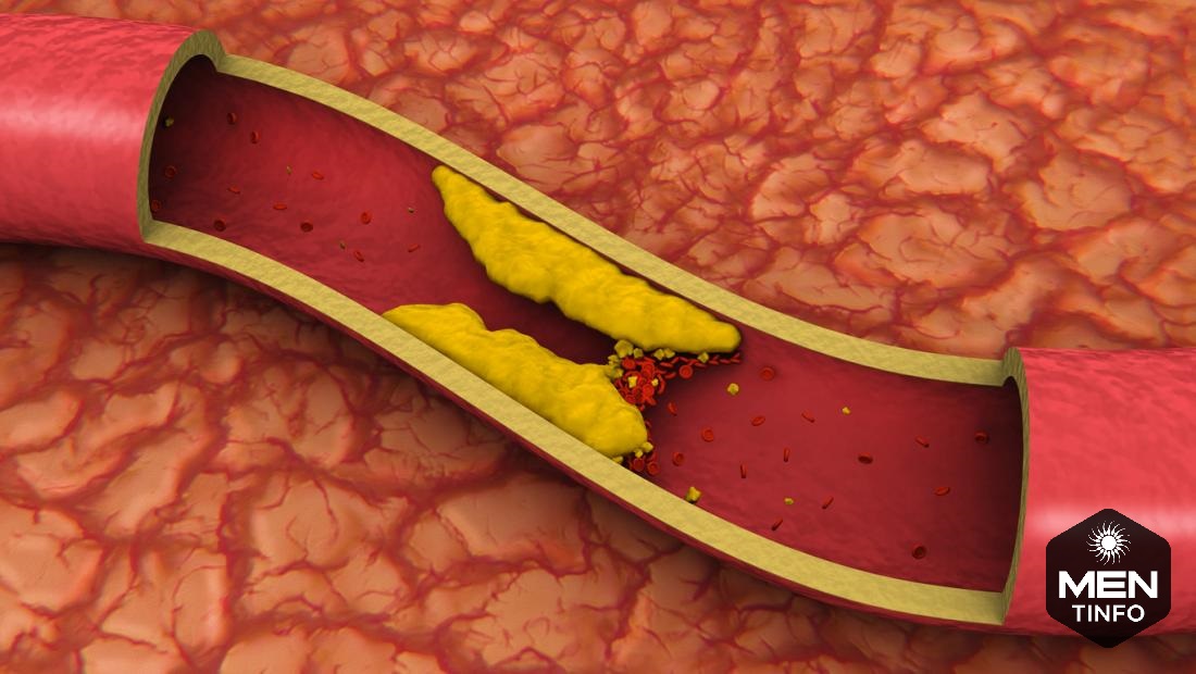 tinh-trung-yeu-uong-thuoc-gi-1